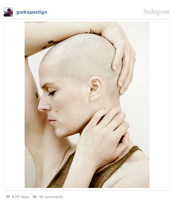 bimba bosé tras la operación de cáncer de mama