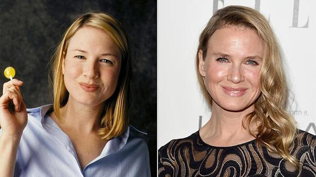 La cirugía de Renée Zellweger