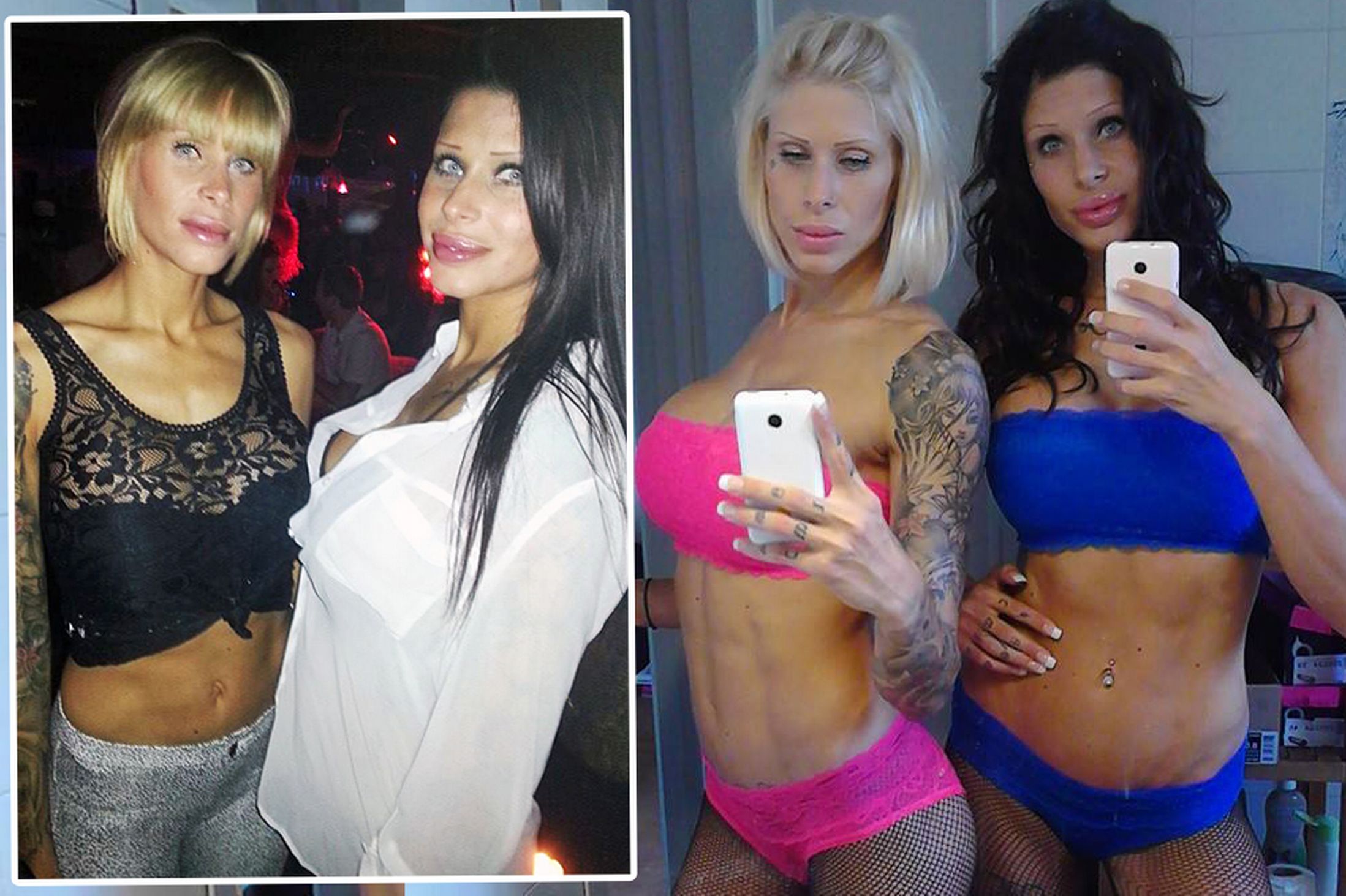 Dos gemelas se someten a infinitas operaciones para parecerse aún más