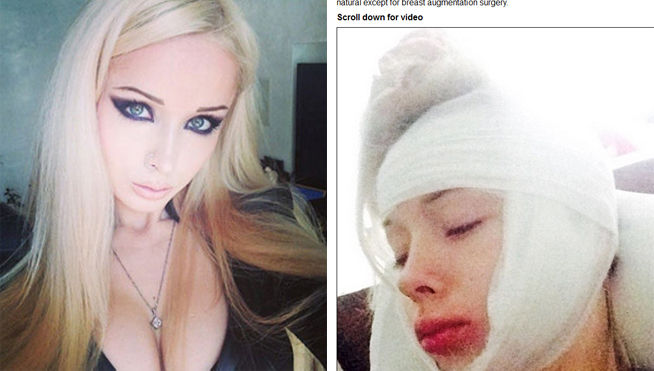 agreden a la barbie humana