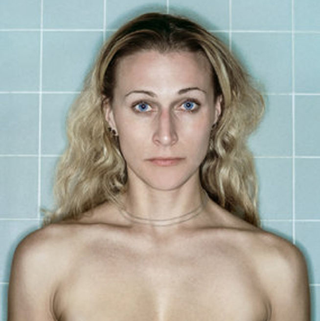 Las asombrosas fotografías que documentan el cáncer de mama