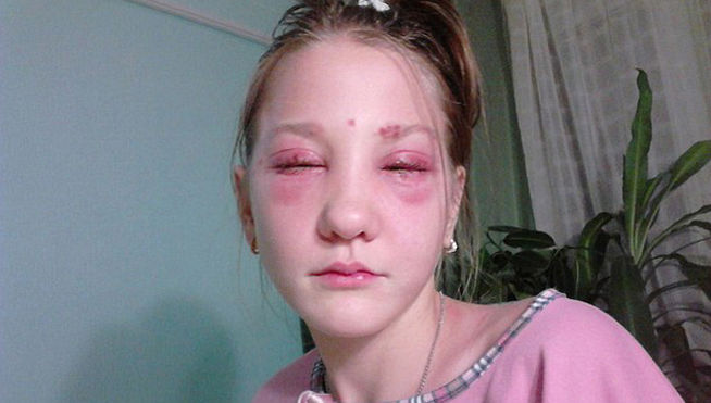 parcialmente ciega por un tinte de pestañas