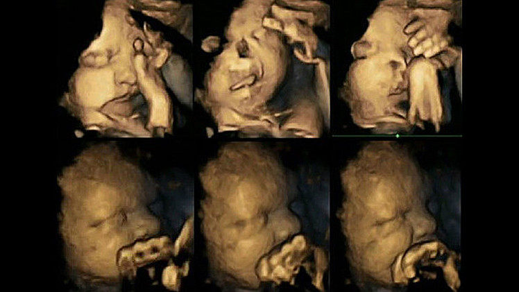 Estas impactantes fotos muestran lo que experimenta un feto de madre fumadora