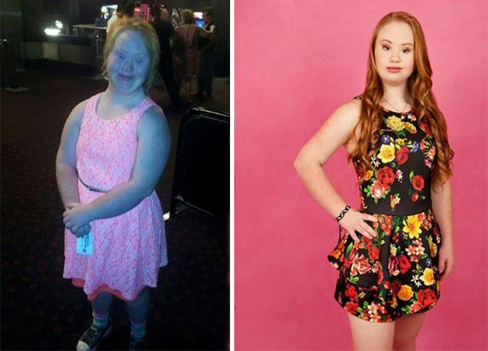 modelo con sindrome de down madeline stuart