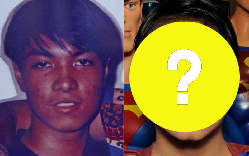 se opera para parecerse a superman