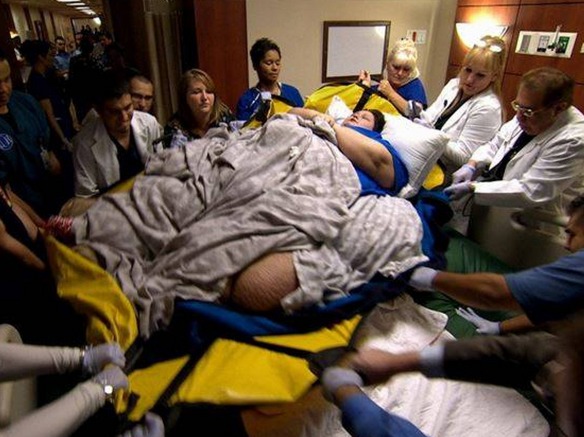 cambio radical mujer mas obesa del mundo