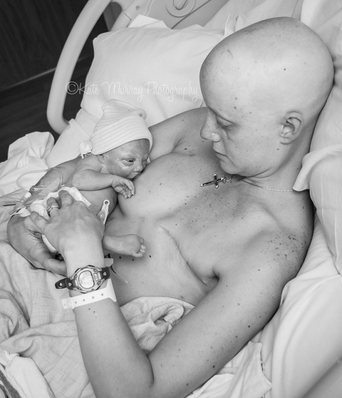 madre con cancer amamantando a su hijo