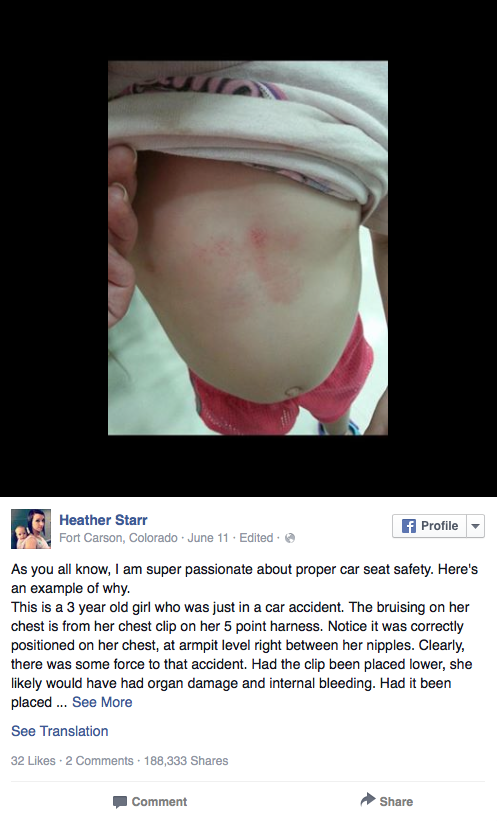 accidente de trafico niña hematomas