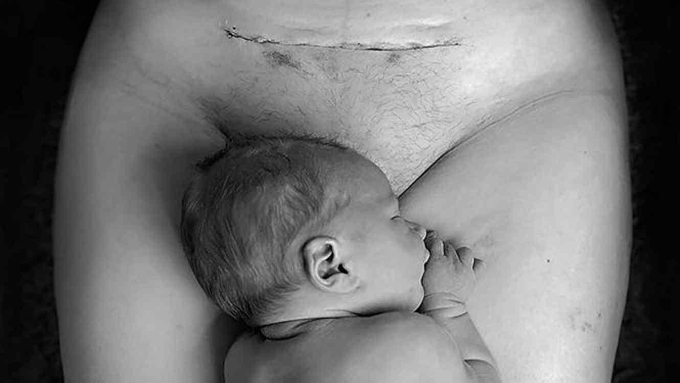 foto viral cesarea y bebe