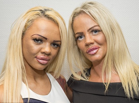 madre e hija adictas a la cirugia