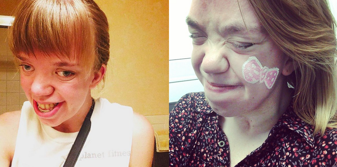 Renee DuShane enfermedad genetica