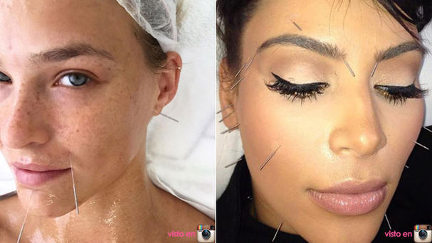 tratamientos de belleza rostro