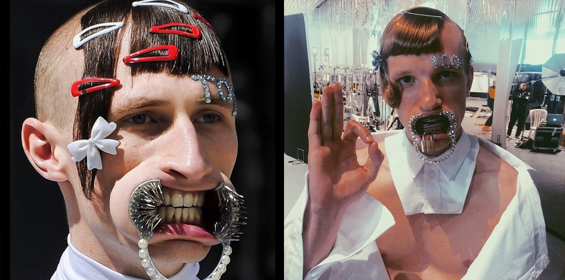 dentaduras metalicas grillz