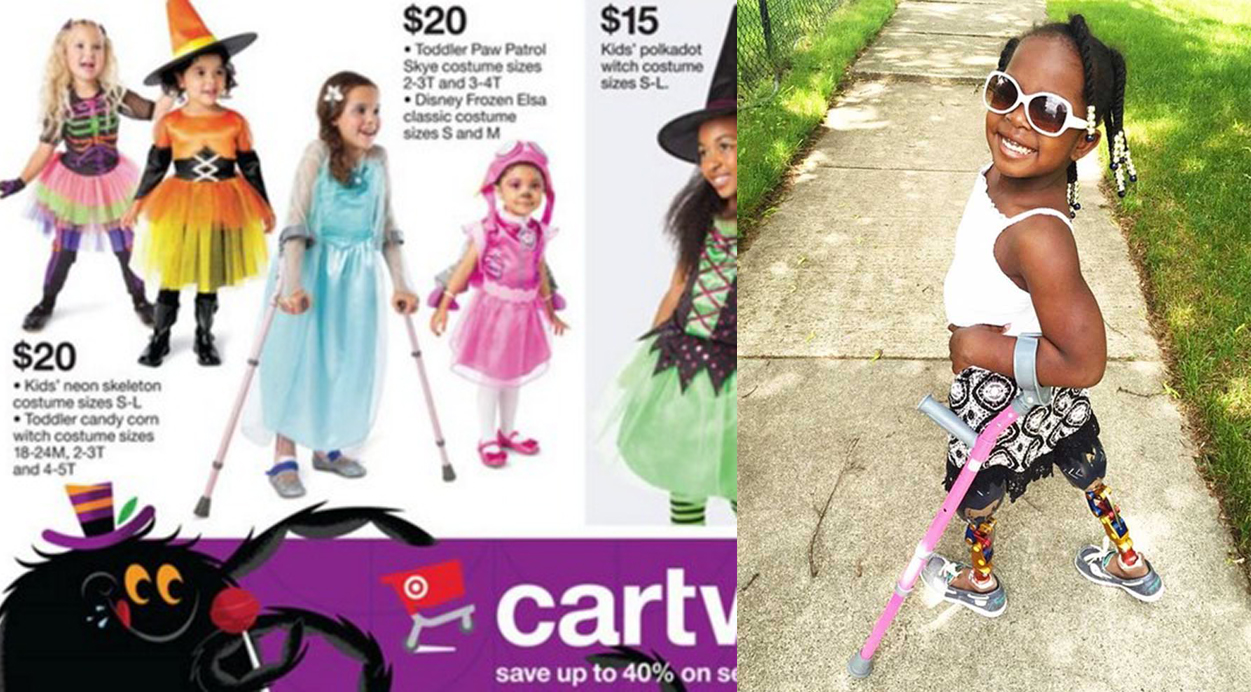 Incluyen a una niña con muletas en un catálogo de disfraces