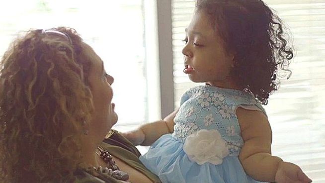 Esta niña sobrevive sin huesos gracias a un medicamento experimental