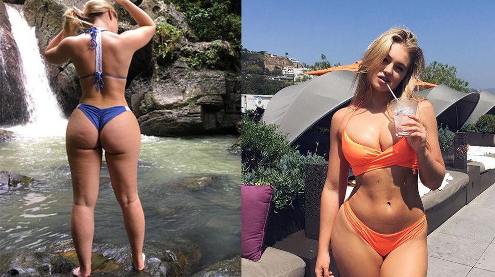 iska lawrence celulitis