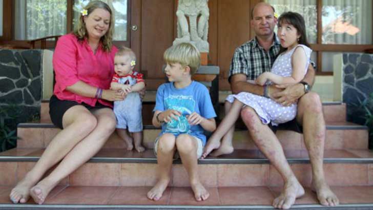 A esta niña le dieron un tratamiento para que nunca creciera