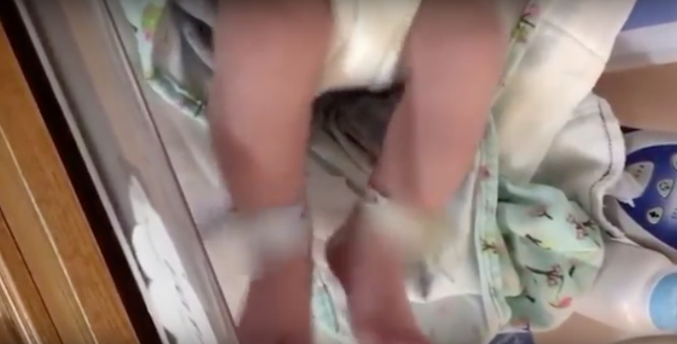 sindrome de abstinencia neonatal