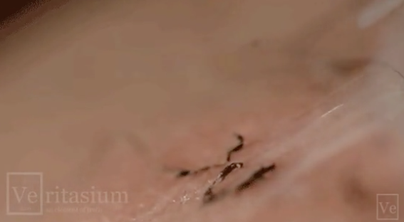 Este vídeo muestra como funciona realmente la depilación láser