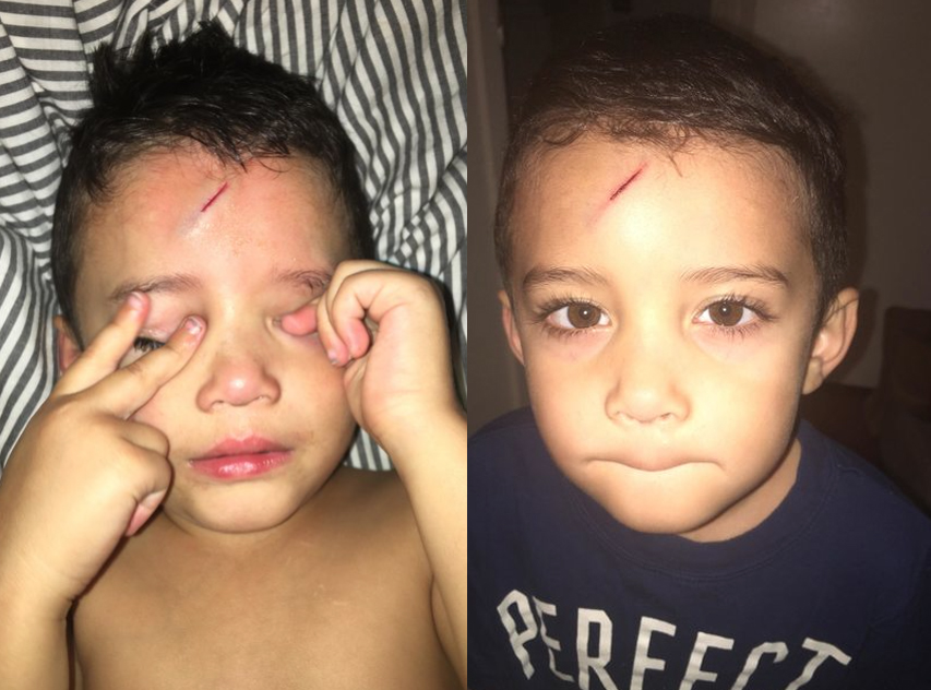 madre arregla cicatriz 