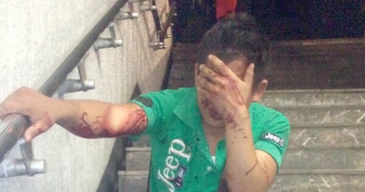 mujer se defendio de su acosador