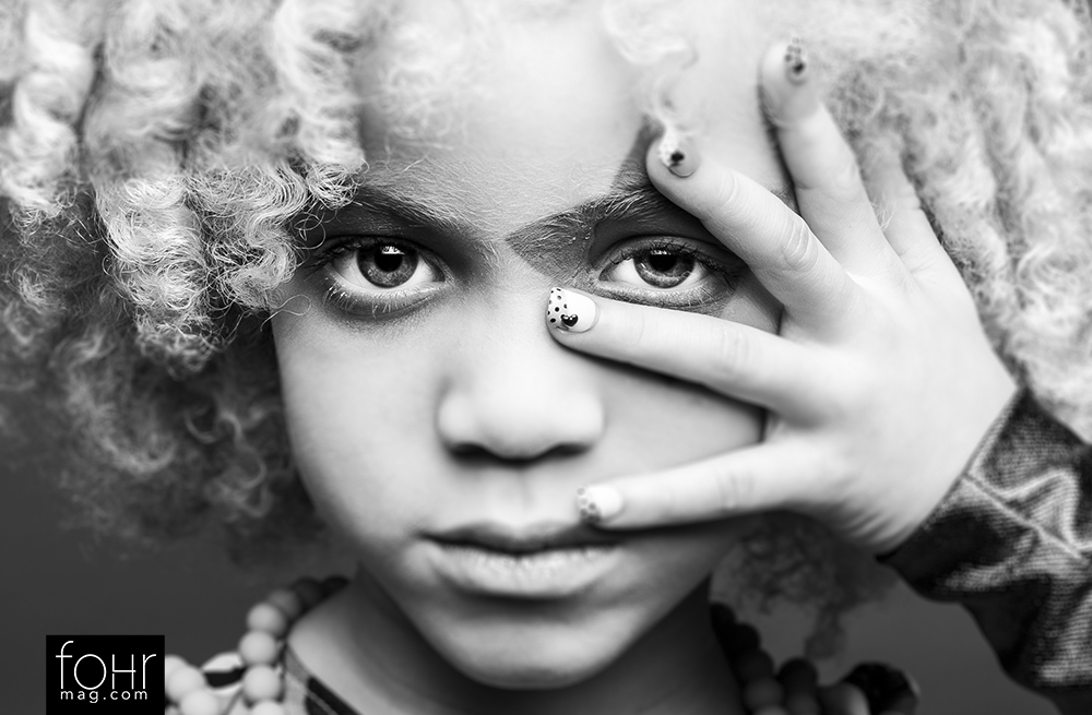 La niña negra albina que arrasa en las revistas de moda