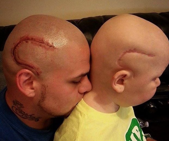 El emotivo gesto de un padre al tatuarse la cicatriz de su hijo
