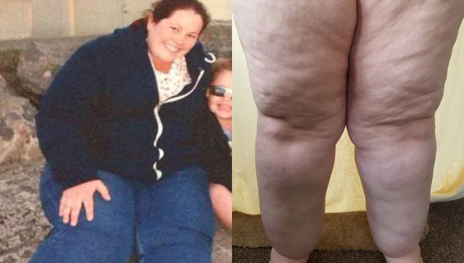 mujer piernas gigantes