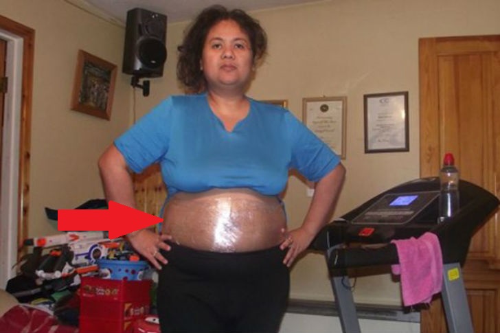 truco casero adelgazar