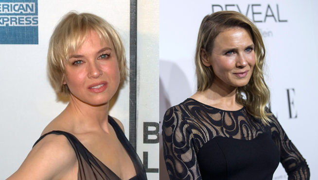 cambio fisico renee zellweger