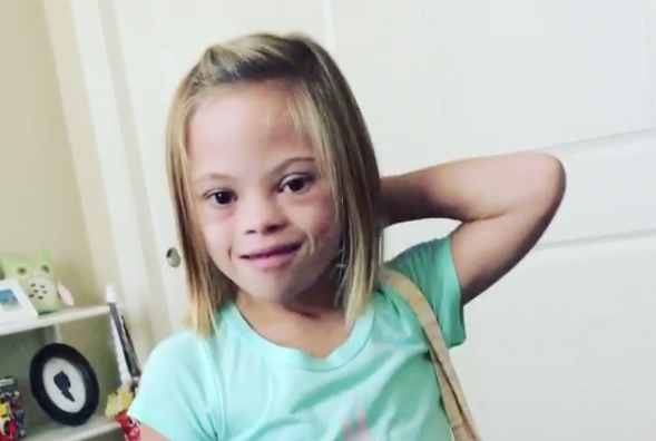 niña sindrome de down 