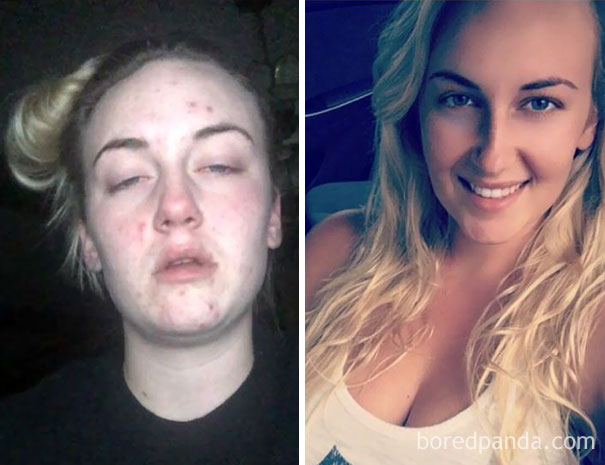 mujeres antes y despues de dejar las drogas
