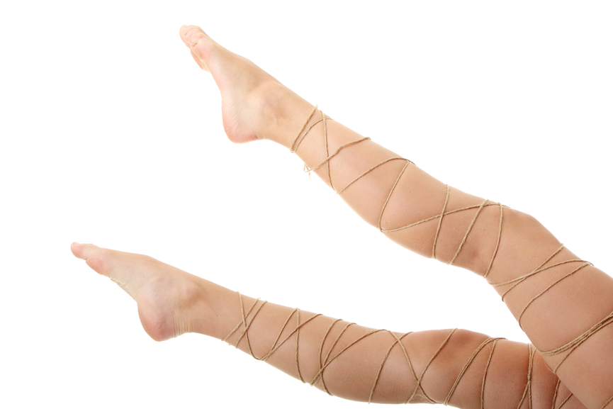 trucos caseros para las varices