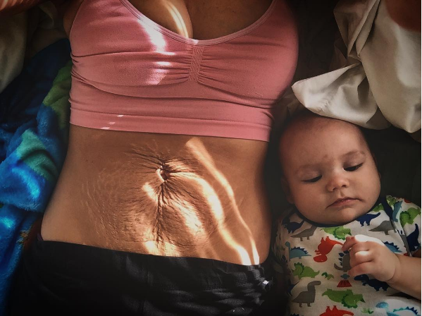 Comparte las marcas de sus dos embarazos para animar a otras madres a sentirse guapas