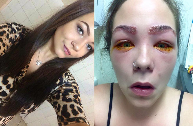 reaccion a tinte de cejas