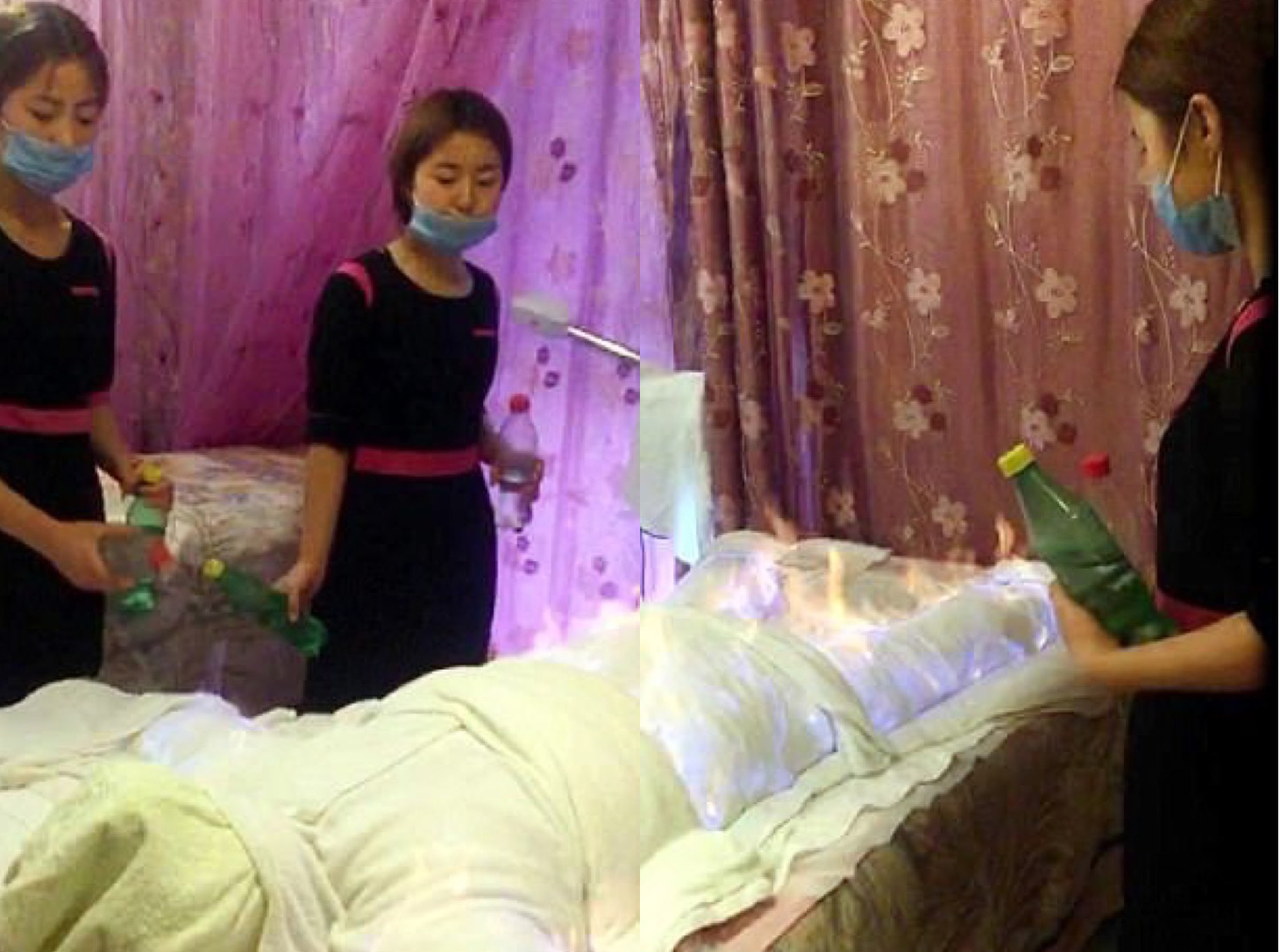 tratamiento de belleza fuego 