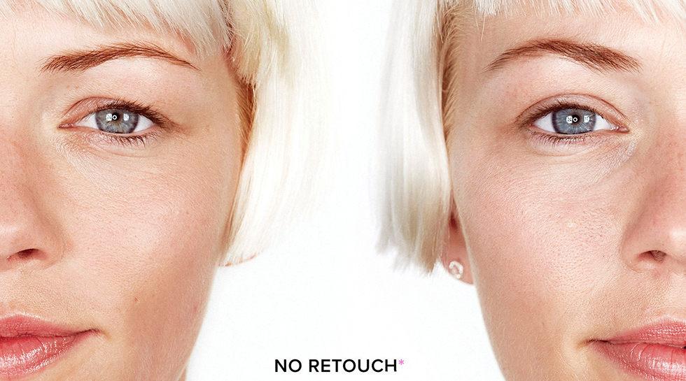 paraches efecto lifting