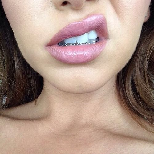 como maquillar los labios con brackets