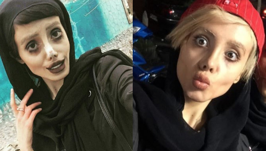 bulo operaciones angelina jolie