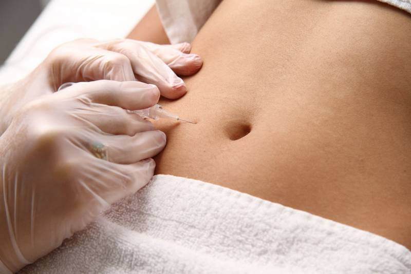 tratamientos esteticos para adelgazar tratamientos esteticos para adelgazar