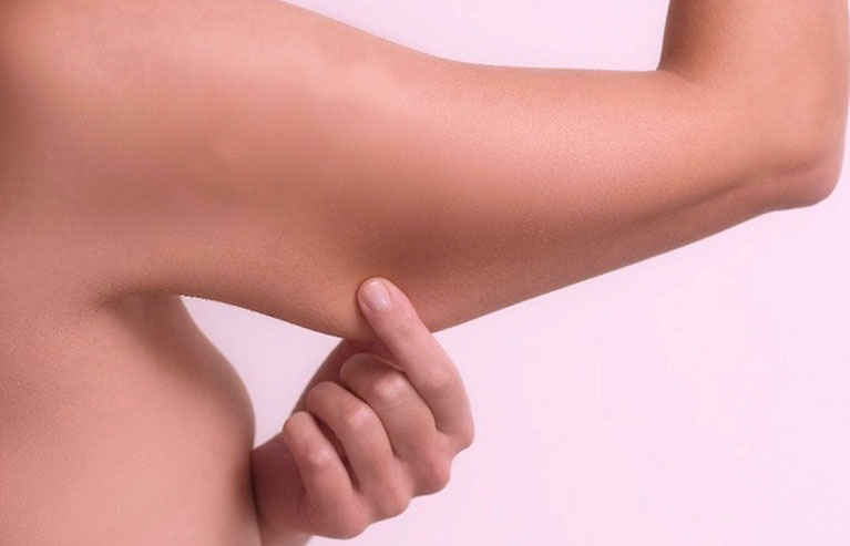 tratamientos esteticos brazos