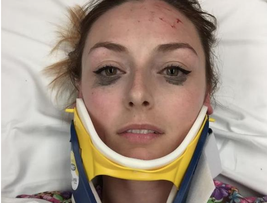 mejor eyeliner del mundo accidente