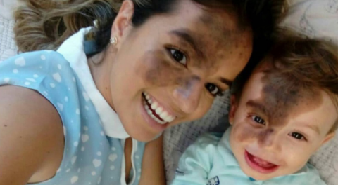 madre se pinta mancha de su hijo