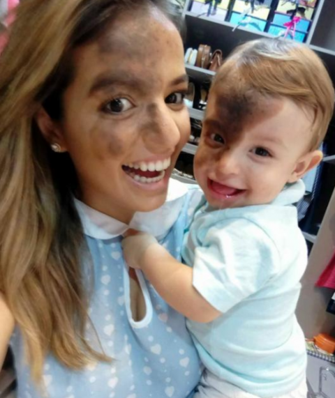 madre se pinta mancha de su hijo