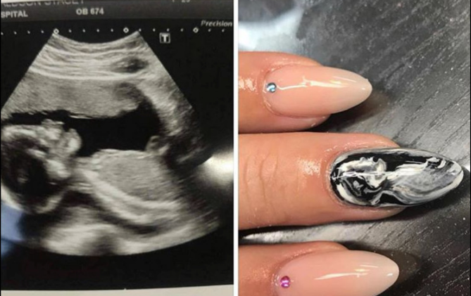 Arrasa entre las embarazadas la manicura con ecografía