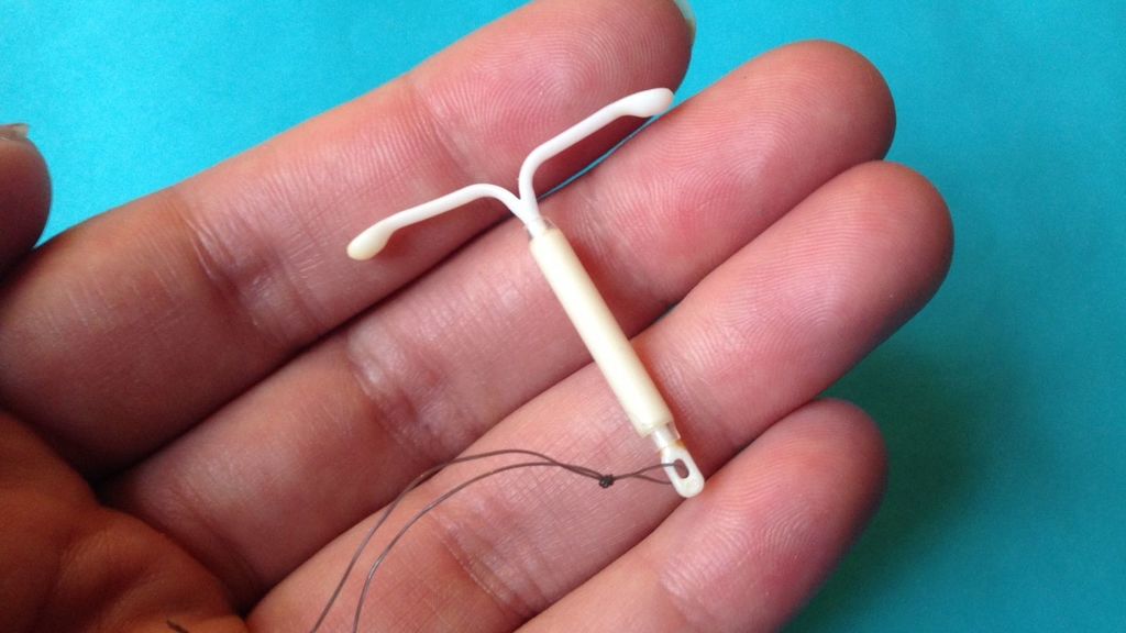 a punto de morir con un diu