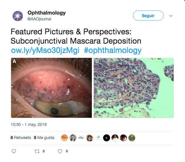 lesiones por no desmaquillarse