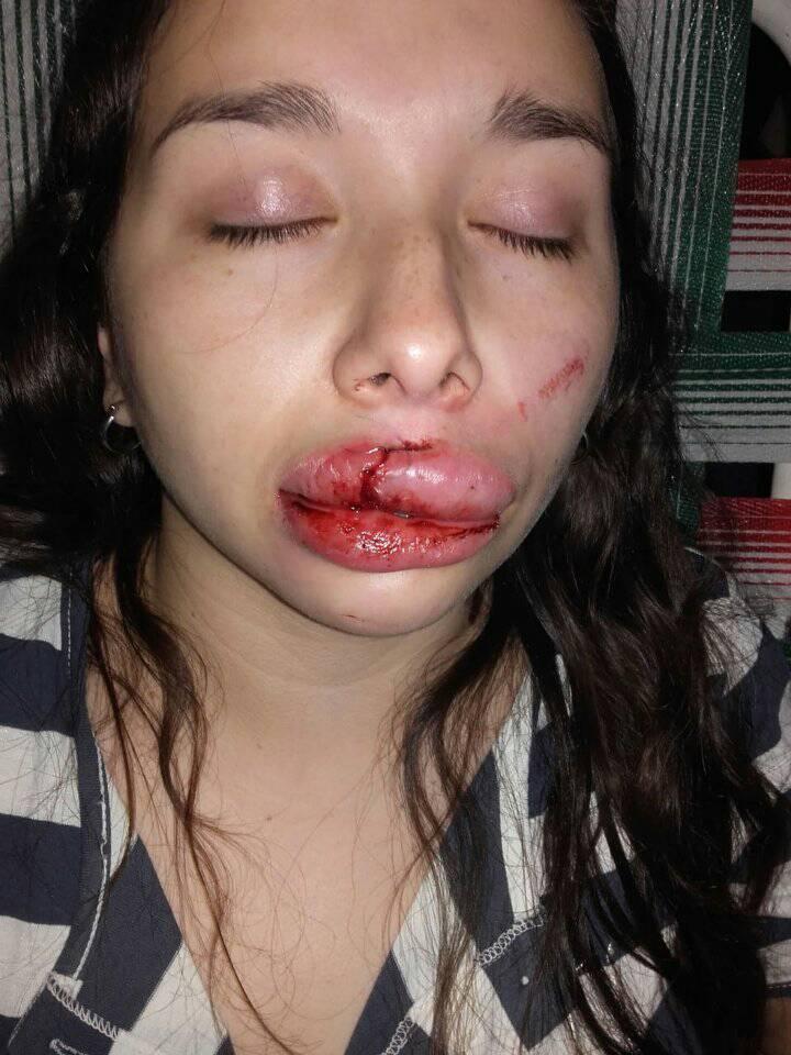 agresion argentina golpe cara1