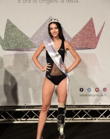 miss italia protesis