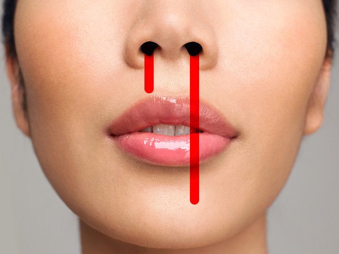 Qué hacer cuando te sangra la nariz